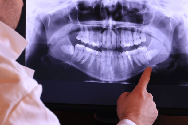 Best Urgent Dental Care for Toothache in Le Mars, IA