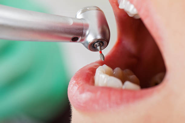Best Broken or Cracked Tooth Emergency Dentist in Le Mars, IA